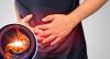 Kararlı bir "hayır" Gastrit söyle: 5 İpuçları uzmanları