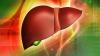 Sağlıklı karaciğerde 10 temel kuralları