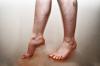 Bacaklardaki kan akışının ihlali:, Belirtileri Nedenleri