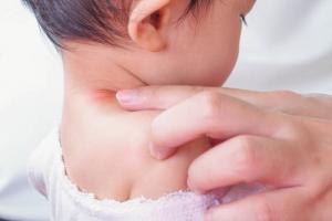 Mantar bir çocuk: enfeksiyon, belirtileri ve tedavi kaynaklar