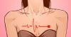 Kadınlarda kalp krizi 5 tuhaf belirtiler
