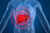 Hastalıklı karaciğer: derideki tezahürleri