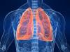 Sigara içenler: nasıl akciğerleri bronşları temizlemek için?